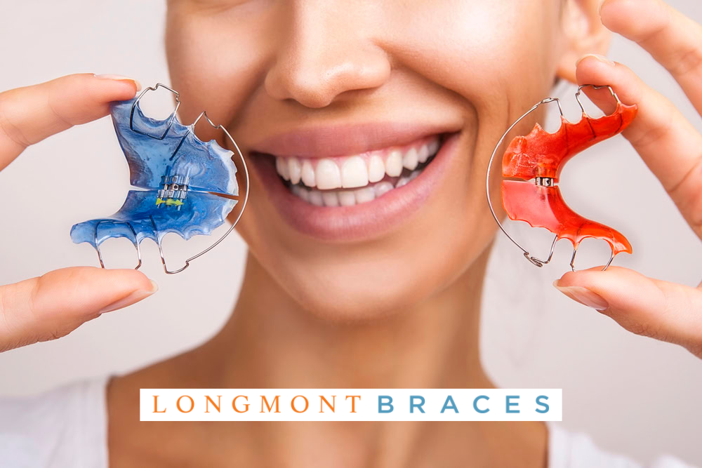 Fun Colors for Braces & Retainers - Longmont Braces